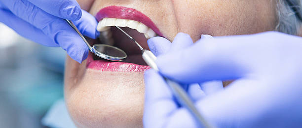 Best Emergency Root Canal Treatment in Belvidere, NJ